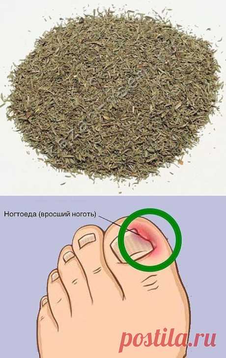 (46) Одноклассники        Вросший ноготь