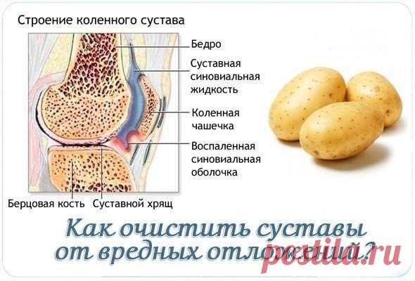 КАК ОЧИСТИТЬ СУСТАВЫ ОТ ВРЕДНЫХ ОТЛОЖЕНИЙ? 
 



Как утверждают многие медики – большинства болезней суставов можно избежать, регулярно проводя их профилактическое очищение. Существует множество способов очищения суставов (в основном это диеты…
