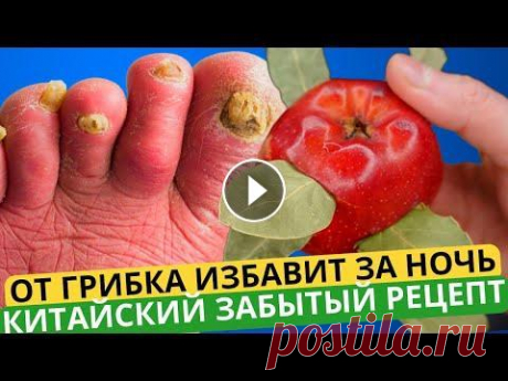 От ГРИБКА НОГТЕЙ можно избавиться НАВСЕГДА за 2 минуты простым... Это точно есть у каждого дома ❗️Включите субтитры и смотрите видео на вашем родном языке!⬆️...