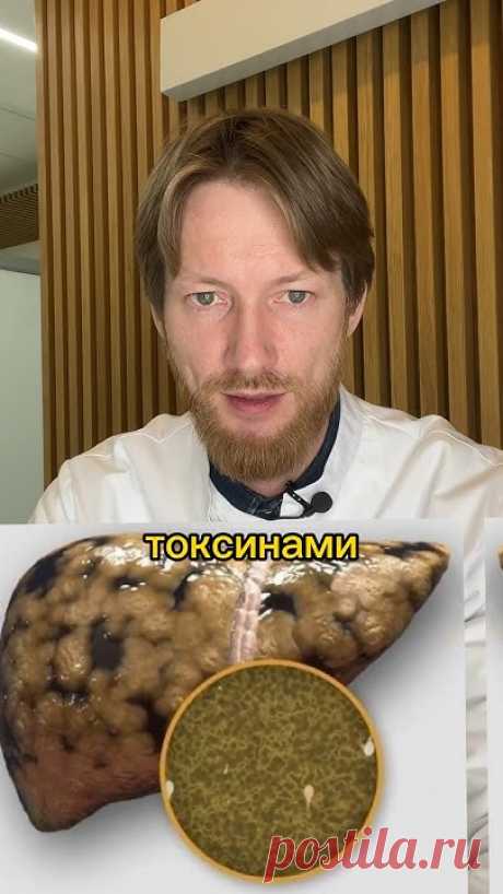 Рецепт для очистки печени и похудения