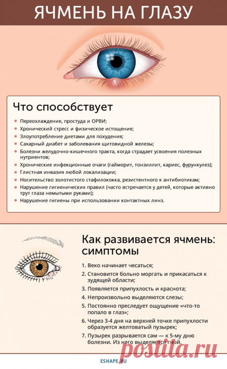 Как быстро вылечить ячмень на глазу