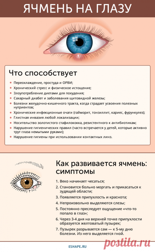 Как быстро вылечить ячмень на глазу