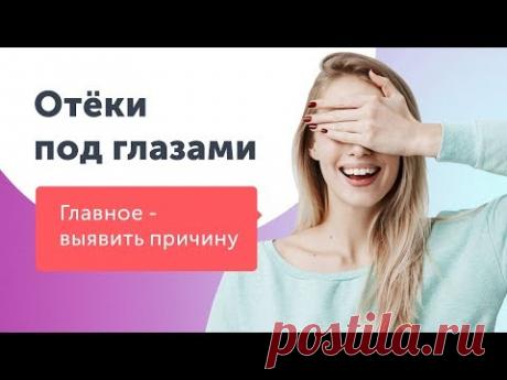 Отеки под глазами. От чего они появляются? - YouTube