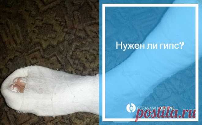 Перелом пальца на ноге симптомы - лечение