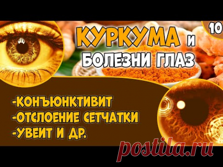 КУРКУМА (видео 10): болезни глаз. Воспаление. Сухость. Увеит. Отслойка сетчатки.