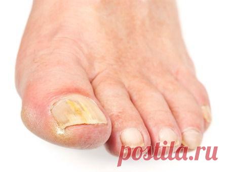 Домашние средства, которые лечат