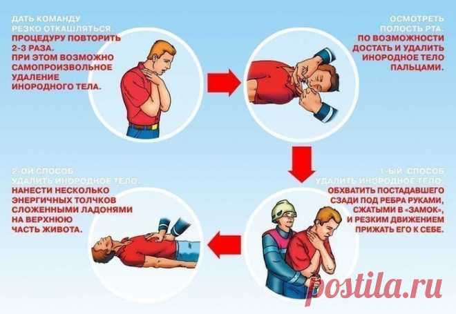 Прием Геймлиха - это надо знать каждому