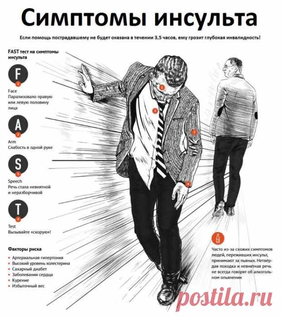 Инсульт головного мозга: 10 фактов, которые вы должны знать