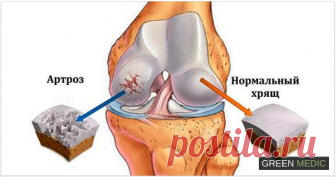 Результаты вы заметите очень скоро! Хрящ действует как подушечка, защищая ваши кости...