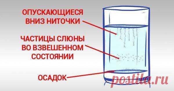 Моментальный тест на молочницу: невероятная точность до 90% ! | Люблю Себя