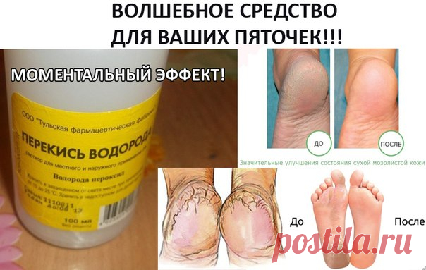 Копеечное средство для ухода за пятками