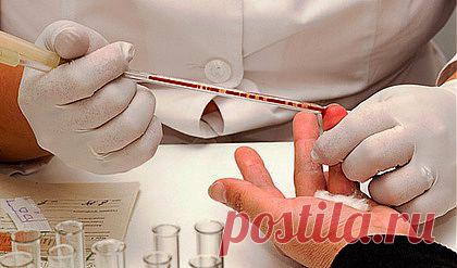 Расшифровка анализов онлайн - Блог Марина на 24open.ru