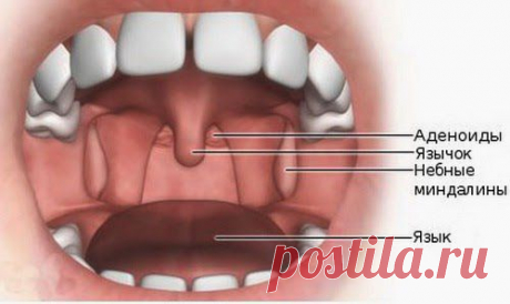 Чистим миндалины и не болеем | Друг пенсионера