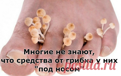 Многие не знают, что средства от грибка у них «под носом»