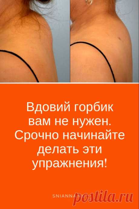 Вдовий горбик вам не нужен. Срочно начинайте делать эти упражнения! (видео) ➡️ Кликайте на фото, чтобы прочитать полностью