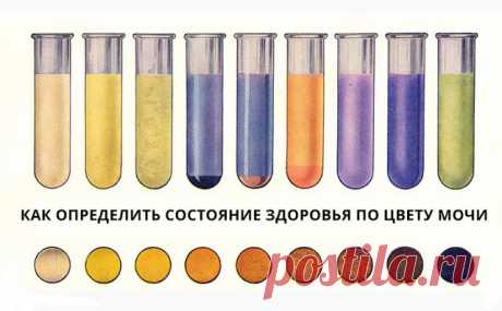 Что говорит о вашем здоровье цвет вашей мочи... Это важнейший показатель! - МирТесен
