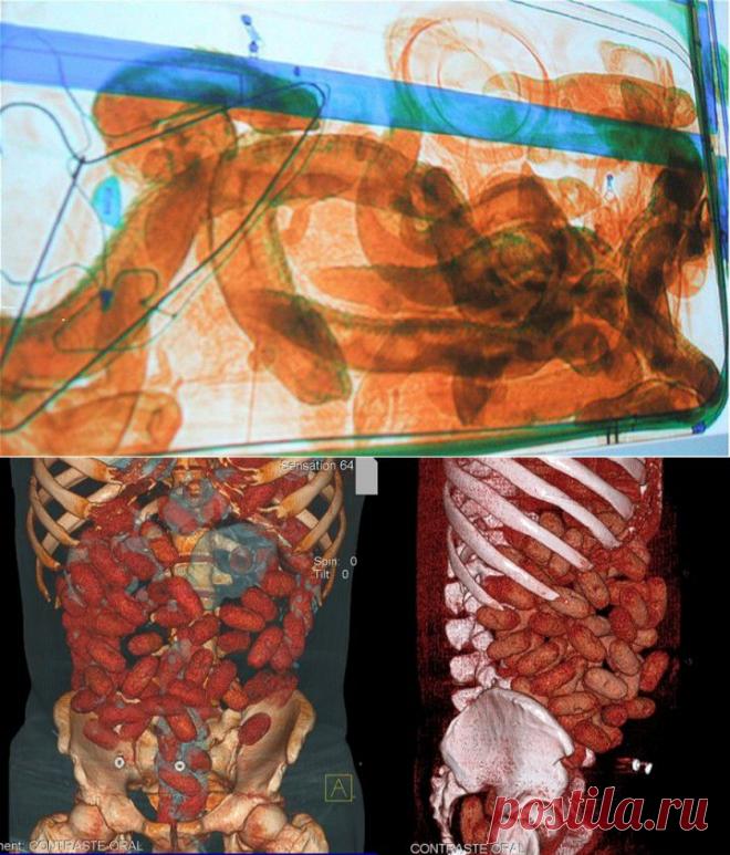 (+1) - Самые необычные находки таможенников | ТУРИЗМ И ОТДЫХ