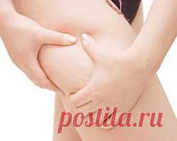 Фиброзный целлюлит - allWomens
