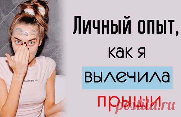 Личный опыт, как я вылечила прыщи — Домашний уют