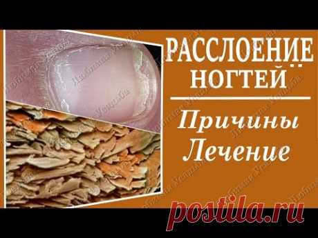 Почему слоятся ногти на руках. Причины Лечение