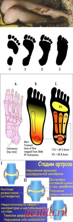 Боли в ногах. Причина и лечение | pokolenie-x.com