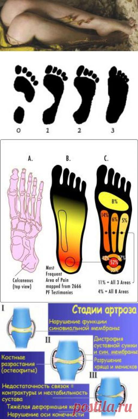 Боли в ногах. Причина и лечение | pokolenie-x.com