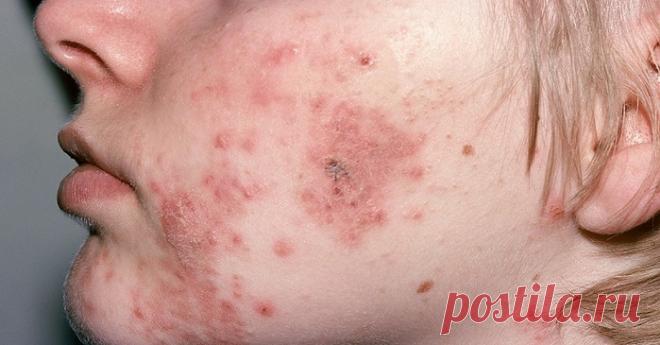 Осторожно! Нынче в общественном транспорте гуляют страшные инфекции… Защити себя!