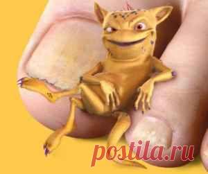 цитата kuzya123452 : Грибок на ногтях ног, лечение для пожилых. (23:51 16-01-2015) [5512739/350309802] - cshjktdbx@mail.ru - Почта Mail.Ru