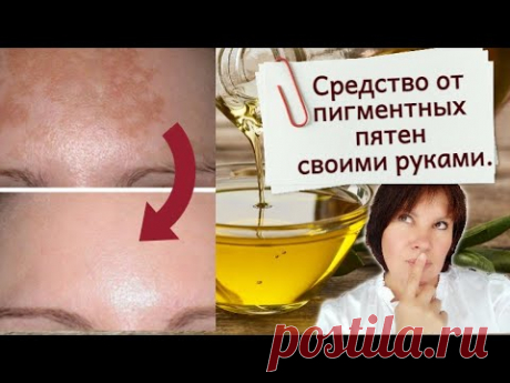 ПИГМЕНТАЦИЯ. Сыворотка от пигментных пятен своими руками. Отбеливание кожи в домашних условиях.