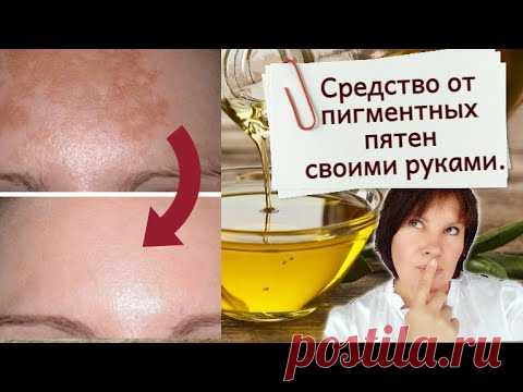ПИГМЕНТАЦИЯ. Сыворотка от пигментных пятен своими руками. Отбеливание кожи в домашних условиях.