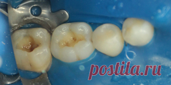 Цены на стоматологию в Краснодаре, сравнение стоимости стоматологических услуг