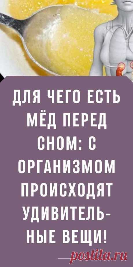 Изображение пина-истории