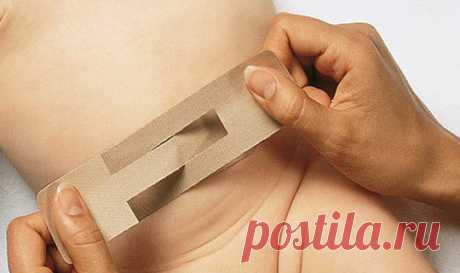 Пупочная грыжа у новорожденного. Лечение грыжи пупка | Дуэт душ