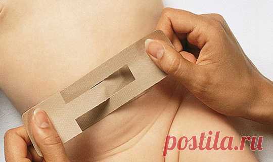 Пупочная грыжа у новорожденного. Лечение грыжи пупка | Дуэт душ