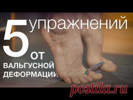 5 упражнений против вальгусной деформации