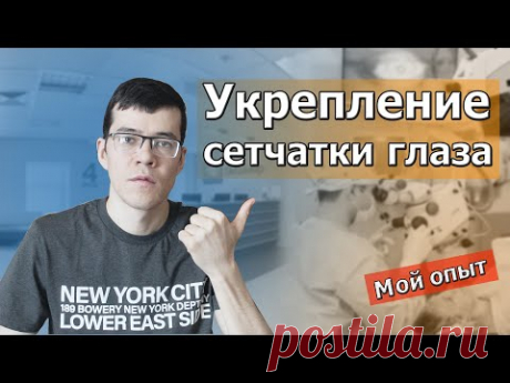 Укрепление сетчатки глаза. Мой опыт. Лазерная коагуляция сетчатки глаза.