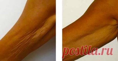 Упражнение «Скручивание». Подтягивает дряблую кожу на руках за неделю. Уделяя 1 минуту в день - Интернет ежедневник - медиаплатформа МирТесен Упражнение «Скручивание». Подтягивает дряблую кожу на руках за неделю. Уделяя 1 минуту в день С возрастом кожа на руках теряет эластичность и обвисает, при отсутствии физической нагрузки в этой области скапливается жировая прослойка. Устранить проблему позволяет упражнение «Скручивание»