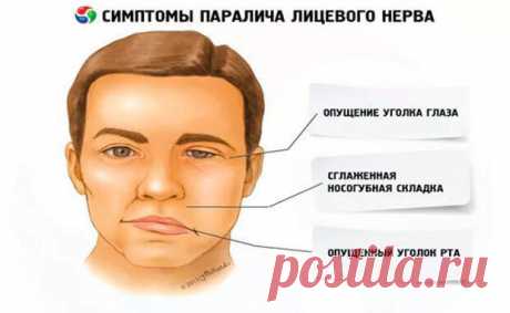Лицо перекосило…
В 2003 году мне поставили диагноз невропатия лицевого нерва. Были асимметрия лица, слезотечение из глаза, глаз не закрывался. В больнице меня лечили хлоридом натрия, хлоридом калия, зуфиллином, дексаметазоном, анальгином, димедролом, лазиксом, нейромультивитом, диклофенаком, луцетамом, алоэ, прозерином, дибазолом, никотиновой кислотой, амитриптилином, МТ, УВЧ, ЛТ, токами...
Читай пост далее на сайте. Жми ⏫ссылку выше