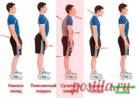 Как не сутулиться? Упражнения для осанки