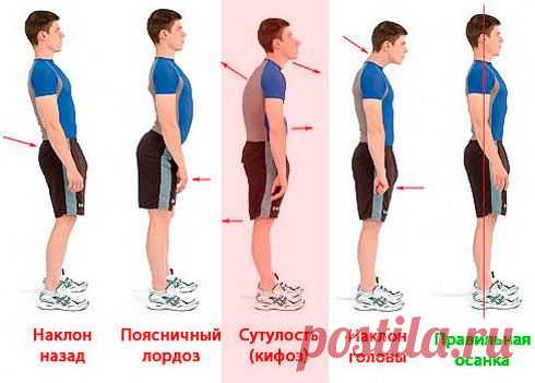 Как не сутулиться? Упражнения для осанки
