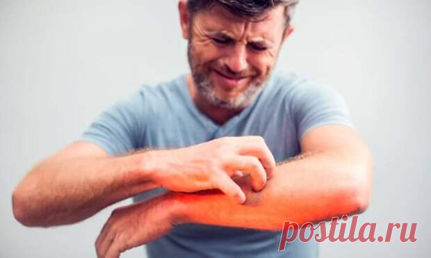 Почему возникает зуд и какая от него есть польза для организма - ПолонСил.ру - социальная сеть здоровья - Медиаплатформа МирТесен Зуд — довольно раздражающее ощущение, знакомое каждому. Оно часто вызывает непреодолимое желание почесаться. При этом в момент чесание человек даже испытывает удовольствие. Но почему вообще мы испытываем это ощущение? Ведь, если оно развилось в процессе эволюции, значит имеет какое-то значение для - 6 февраля - 43450521725 - Медиаплатформа МирТесен