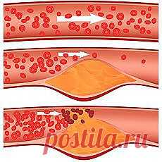 (1 непрочетено) - АБВ поща