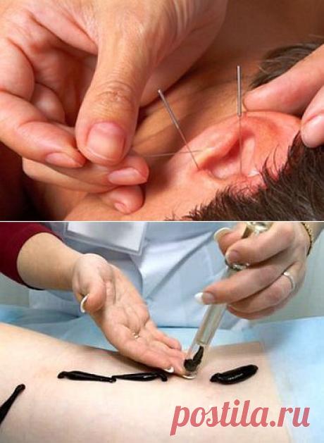 6 древних методов лечения, используемых в медицине до сих пор | Я ЗДОРОВ!