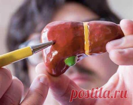 Первичный билиарный цирроз  (код МКБ-10; код МКБ-11): описание, причины, симптомы, как лечить | Клиника лечения боли: врачи онлайн