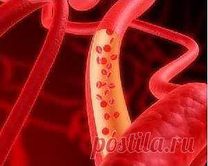 Здоровье-остеохондроз,артроз,остеопороз,ревматизм и т.д...