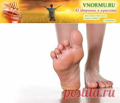 Пяточная шпора: симптомы и диагностика