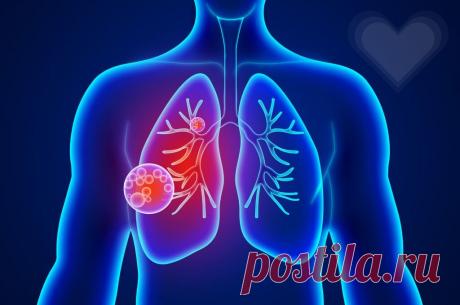 ХОБЛ — хроническая обструктивная болезнь легких | Здравсити | Дзен