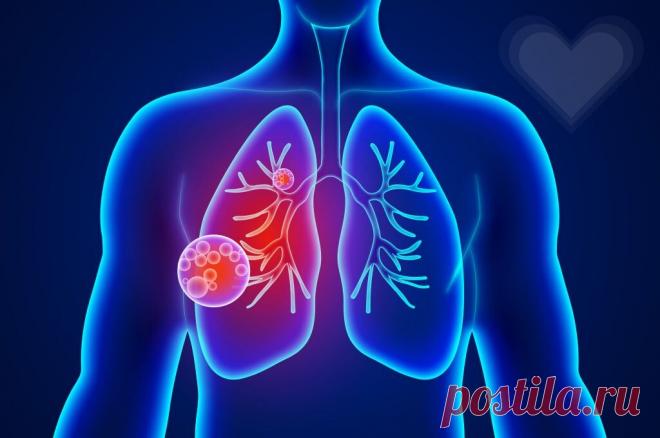 ХОБЛ — хроническая обструктивная болезнь легких | Здравсити | Дзен