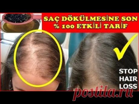 #SaçÇoğaltan %100 ETKİLİ-1 HAFTADA SAÇ ÇIKARTIYOR-SAÇ DÖKÜLMESİNE SON!EV YAPIMI DOĞAL TARİF #Dökülme