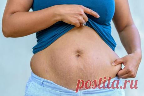 5 причин большого живота, не связанных с регулярным перееданием - Все обо Всем